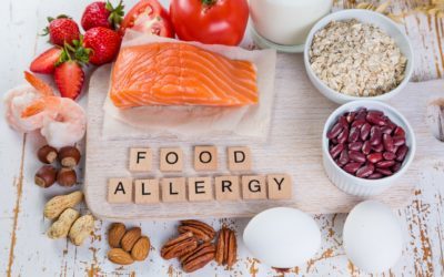 Free Food Allergy Substitution Chart – 8 Common Allergens