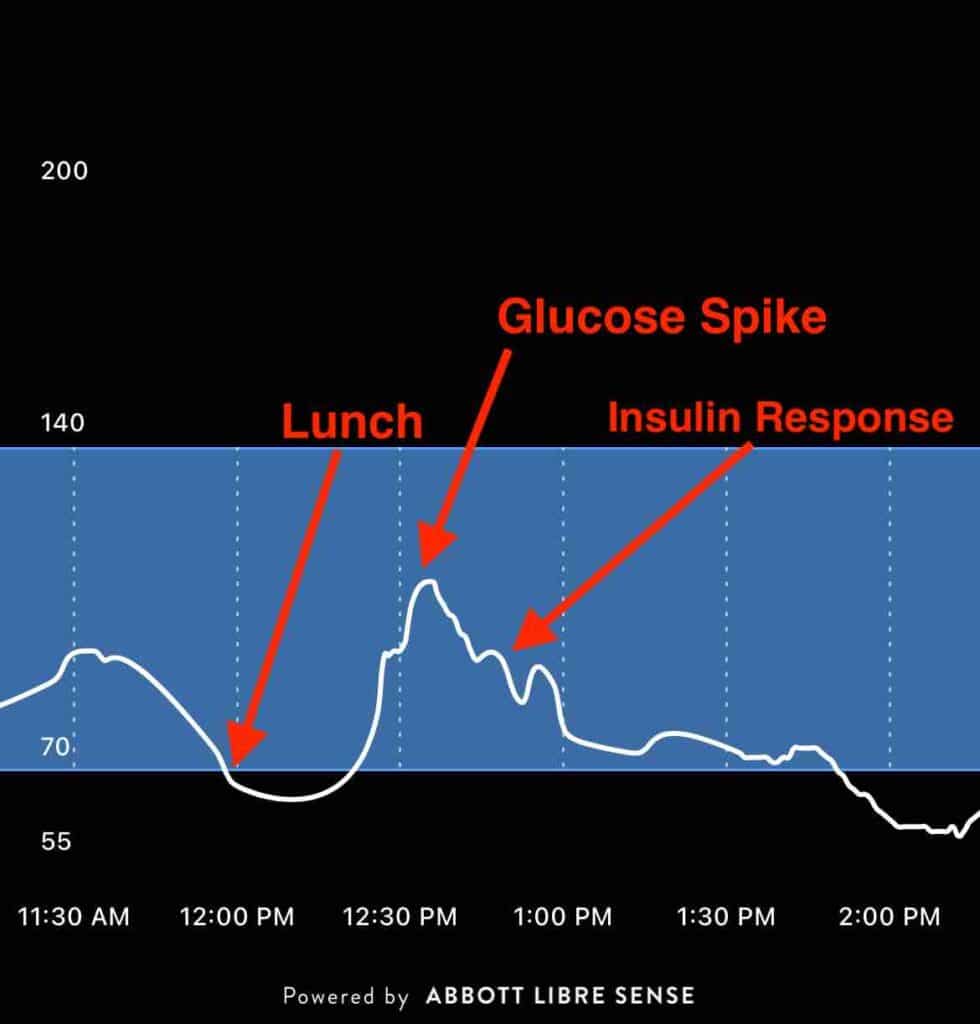 Post meal glucose spike with insulin response.